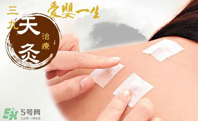 贴三伏贴可以吃鱼吗？贴三伏贴可以吃什么鱼？