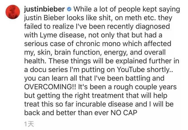 贾斯汀比伯和艾薇儿谁更火(艾薇儿退出乐坛)(5)