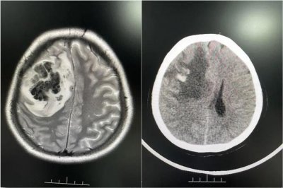 ​广东25岁女主播突然昏迷不醒！医生提醒：与这些行为有关→