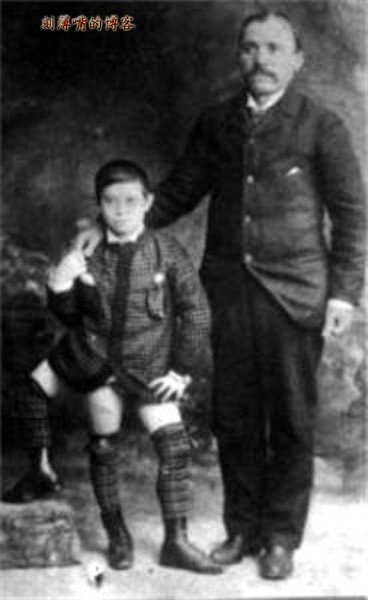 世界上真有三条腿的男人