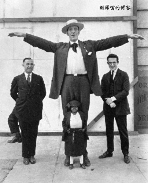 世界上真有三条腿的男人