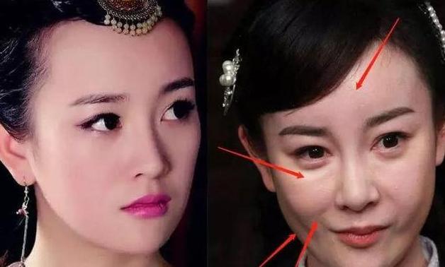 四大女星大方承认整容（娱乐圈这8位女星被整容毁掉）(7)