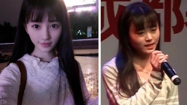 四大女星大方承认整容（娱乐圈这8位女星被整容毁掉）(33)