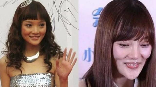 四大女星大方承认整容（娱乐圈这8位女星被整容毁掉）(3)