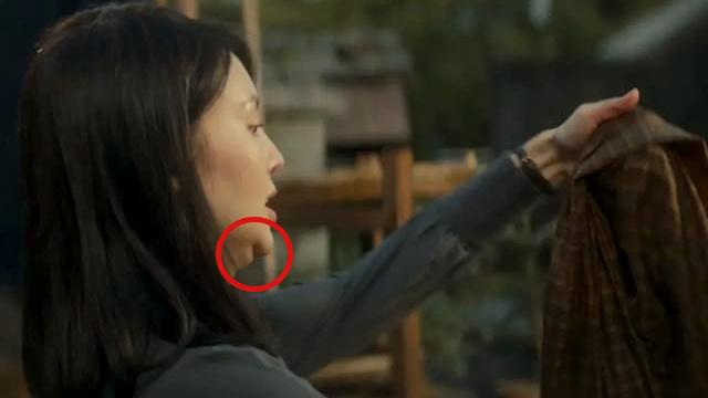 四大女星大方承认整容（娱乐圈这8位女星被整容毁掉）(21)