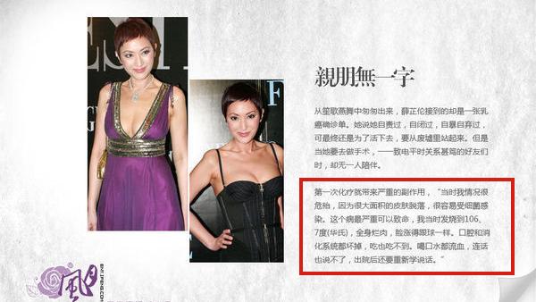 四大女星大方承认整容（娱乐圈这8位女星被整容毁掉）(27)