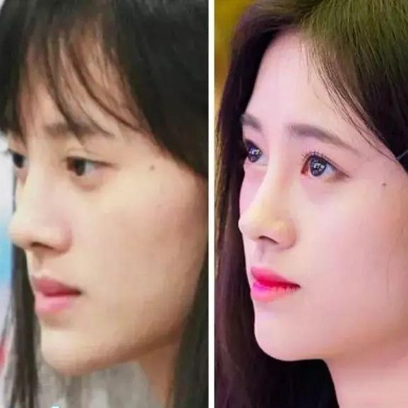 四大女星大方承认整容（娱乐圈这8位女星被整容毁掉）(34)