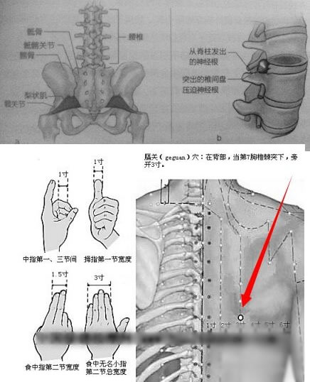 后背疼痛位置图详解图片 需要注意及时就医