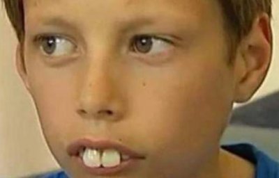 ​“兔牙”有多影响颜值？当男孩矫正牙齿后判若两人，瞬间帅成校草