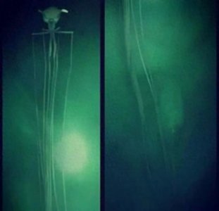 ​几张让你恐惧的图片，胆小鬼坚持不了几张，恐惧症患者慎入