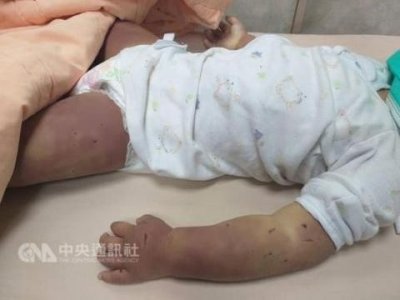 ​台1岁女童疑遭母亲等4人虐待致死 生父崩溃：爸爸对不起你