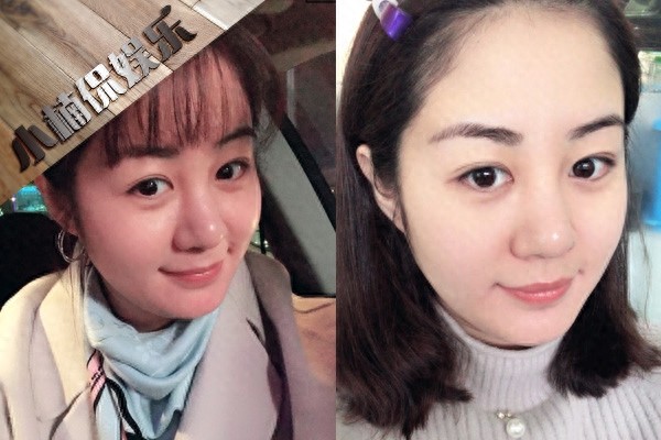 28岁毕畅近照，演《乡村爱情》王小蒙走红，嫁富豪老公