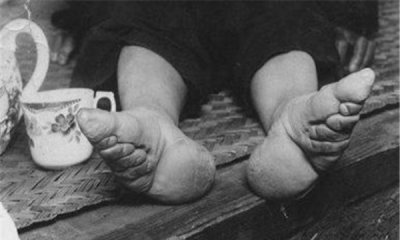 ​女人裹足什么时间解除的？中华民国创造后完全解除