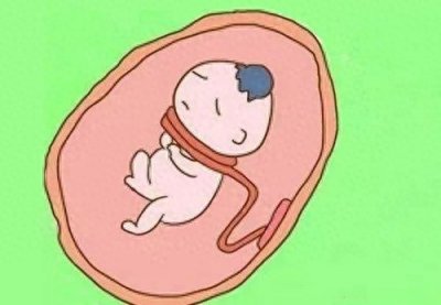 ​常见的胎儿脐带绕颈，别慌，专业医生教你看懂它
